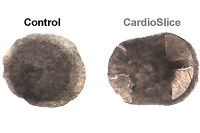 'CardioSlice', una nova tecnologia capaç de produir teixit cardíac artificial