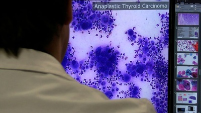 Patòleg analitzant mostres histopatològiques amb DigiPatICS. Autoria: Vall d'Hebrón
