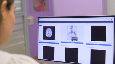 Andrea Barrosso davant la pantalla d'ordinador visualitzant el diagnòstic de malformacions cerebrals