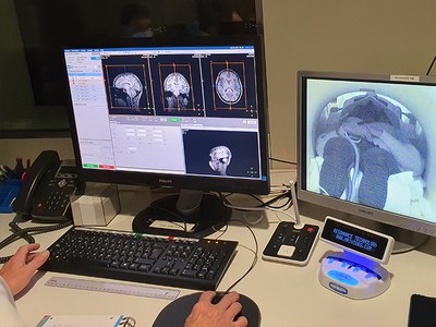 Images showing the results of the tests that made it possible to observe the changes in brain connectivity.