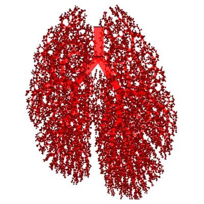 A computational model to understand the dynamics of tuberculosis lesions within the lungs