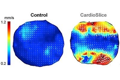 'CardioSlice', una nueva tecnología capaz de producir tejido cardíaco artificial
