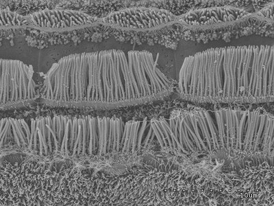 Células del epitelio sensorial interno del estatocisto del pulpo común ('Octopus vulgaris') vistas por microscopía electrónica de barrido
