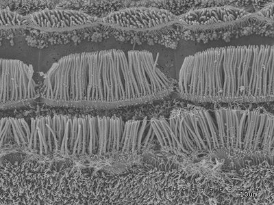 Células del epitelio sensorial interno del estatocisto del pulpo común ('Octopus vulgaris') vistas por microscopía electrónica de barrido