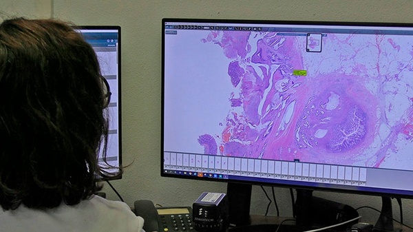 Patóloga visualizando muestras histopatológicas a través de las herramientas de DigiPatICS. Autoría: Vall d'Hebrón