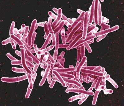 La tuberculosis ha dado forma a la sociedad humana desde la edad de piedra