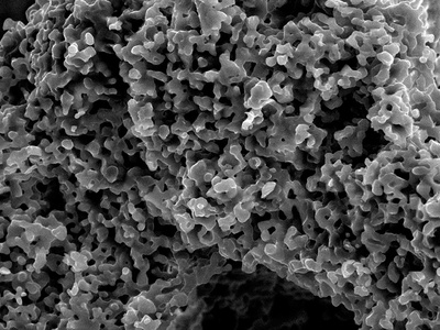 Imagen de microscopía electrónica de un material de fosfato de calcio para regeneración ósea
