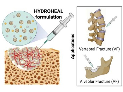 Gráfico de la aplicación de HYDROHEAL